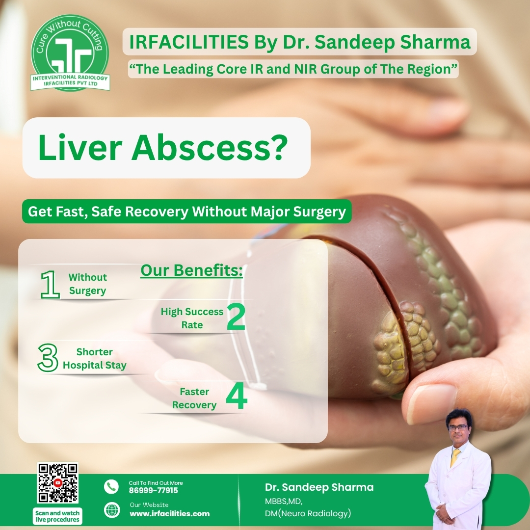 Benefits of Liver Abscess Drainage